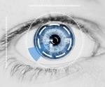 AI model for detecting ocular disease using retinal images