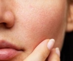 Skin under pressure: tension affects skin's reaction to pollution