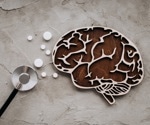 Microglial states and their impact on Alzheimer's disease