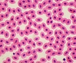 How to optimize nuclei extraction & counting for single cell sequencing