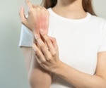 Study highlights the patient heterogeneity in atopic dermatitis and demonstrates the promises of personalized treatment