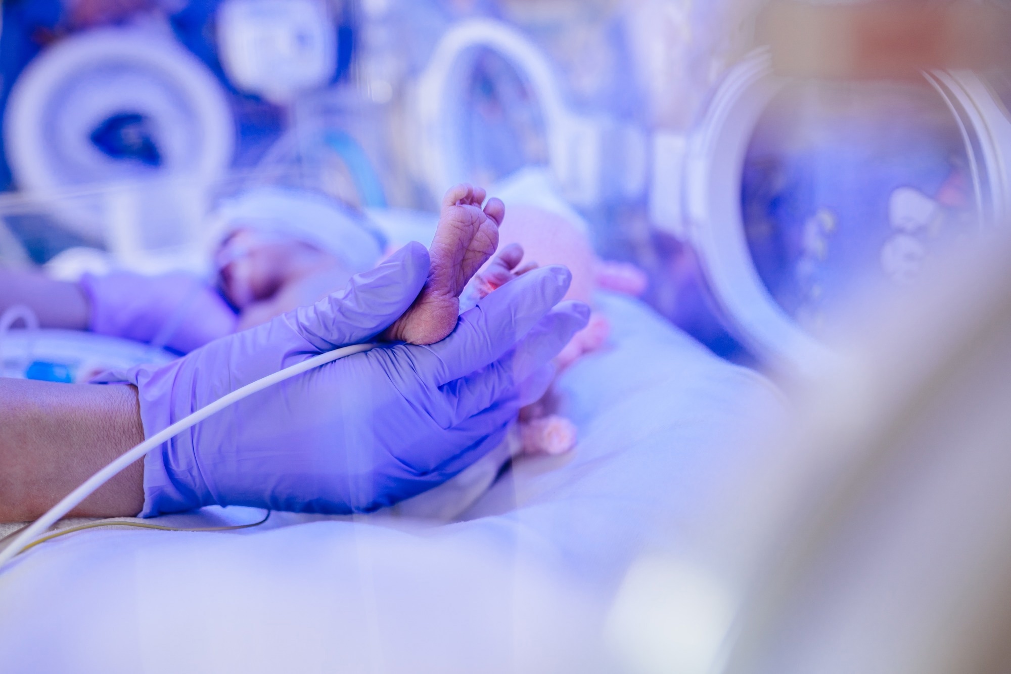 Study: Immaturity of immune cells around the dural venous sinuses contributes to viral meningoencephalitis in neonates. Image Credit: Iryna Inshyna/Shutterstock.com