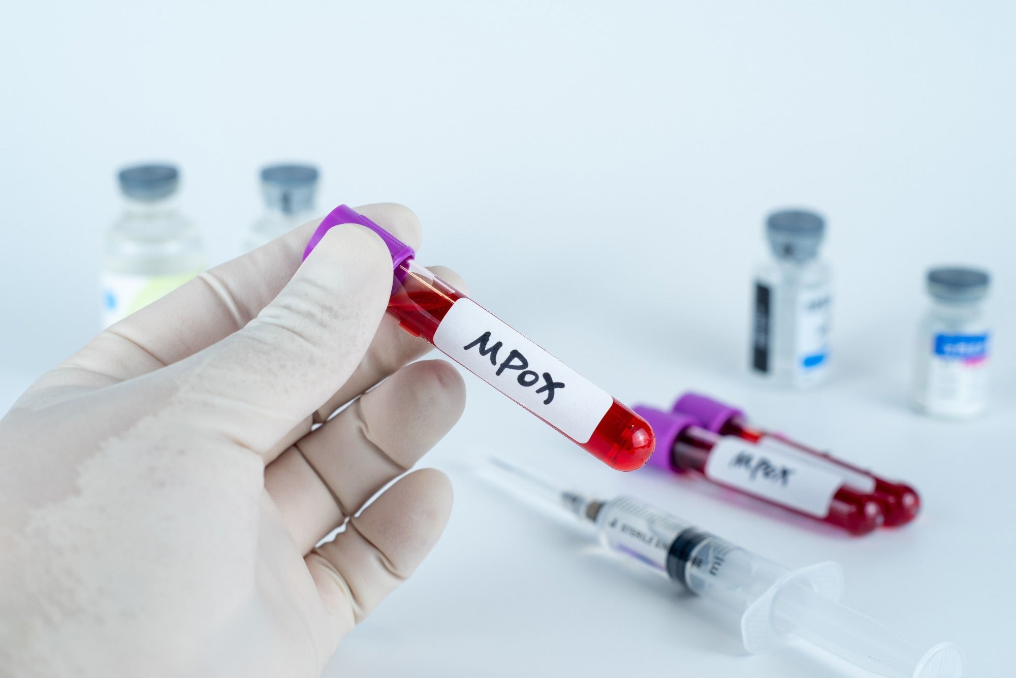 Study: Stability of Monkeypox Virus in Body Fluids and Wastewater. Image Credit: QINQIE99/Shutterstock.com