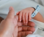 Linking perinatal events to juvenile idiopathic arthritis-uveitis