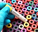 New insights into why obesity puts individuals at risk for severe influenza