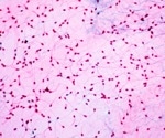 How one gene shakes up our understanding of male infertility