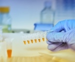 Biomarker discovery boosts long-COVID prediction accuracy to 78.5%
