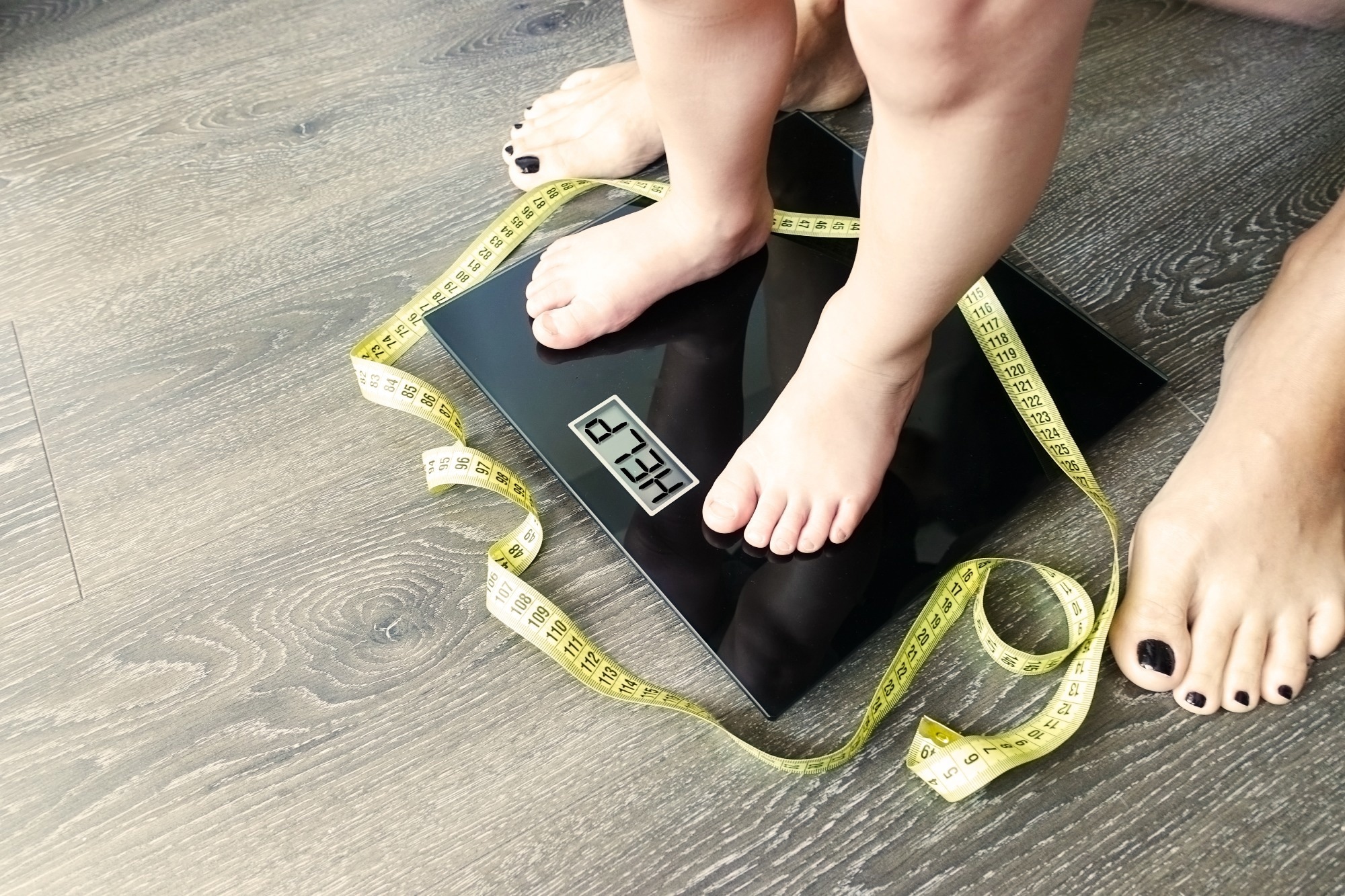 Study: Estimating the effects of preventive and weight-management interventions on the prevalence of childhood obesity in England: a modelling study. Image Credit: Eviart/Shutterstock.com