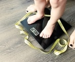 Childhood obesity in England could be curbed with systematic interventions, study suggests