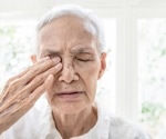 AI Integration in the Fight Against Age-Related Macular Degeneration