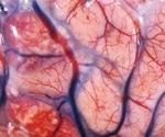 Senolytics show promise in combating brain aging and COVID-19 neuropathology
