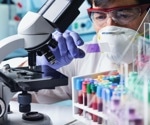 Sickle Cell Disease patients and the use of disease-modifying treatments