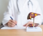 Study identifies key markers for early detection of fatty liver disease in obese and non-obese individuals