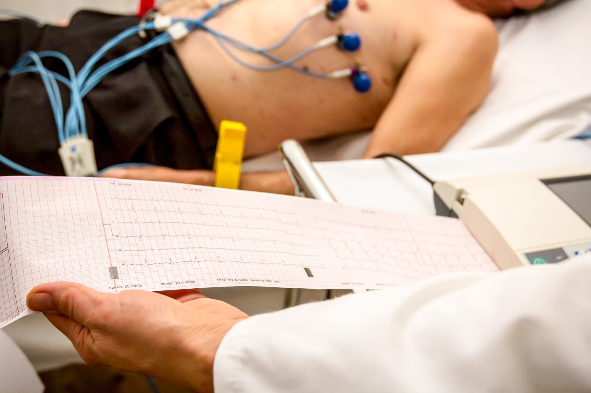 Study: Real-time machine learning model to predict in-hospital cardiac arrest using heart rate variability in ICU. Image Credit: Roman023_photography/Shutterstock.com