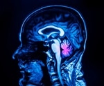 The role of the brainstem in appetite suppression