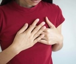 The impact of implementing a high sensitivity assay for cardiac troponin I on long term outcomes in patients with suspected acute coronary syndrome