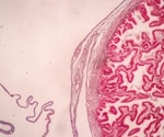 Study links placental Group B Streptococcus to higher neonatal unit admissions in newborns