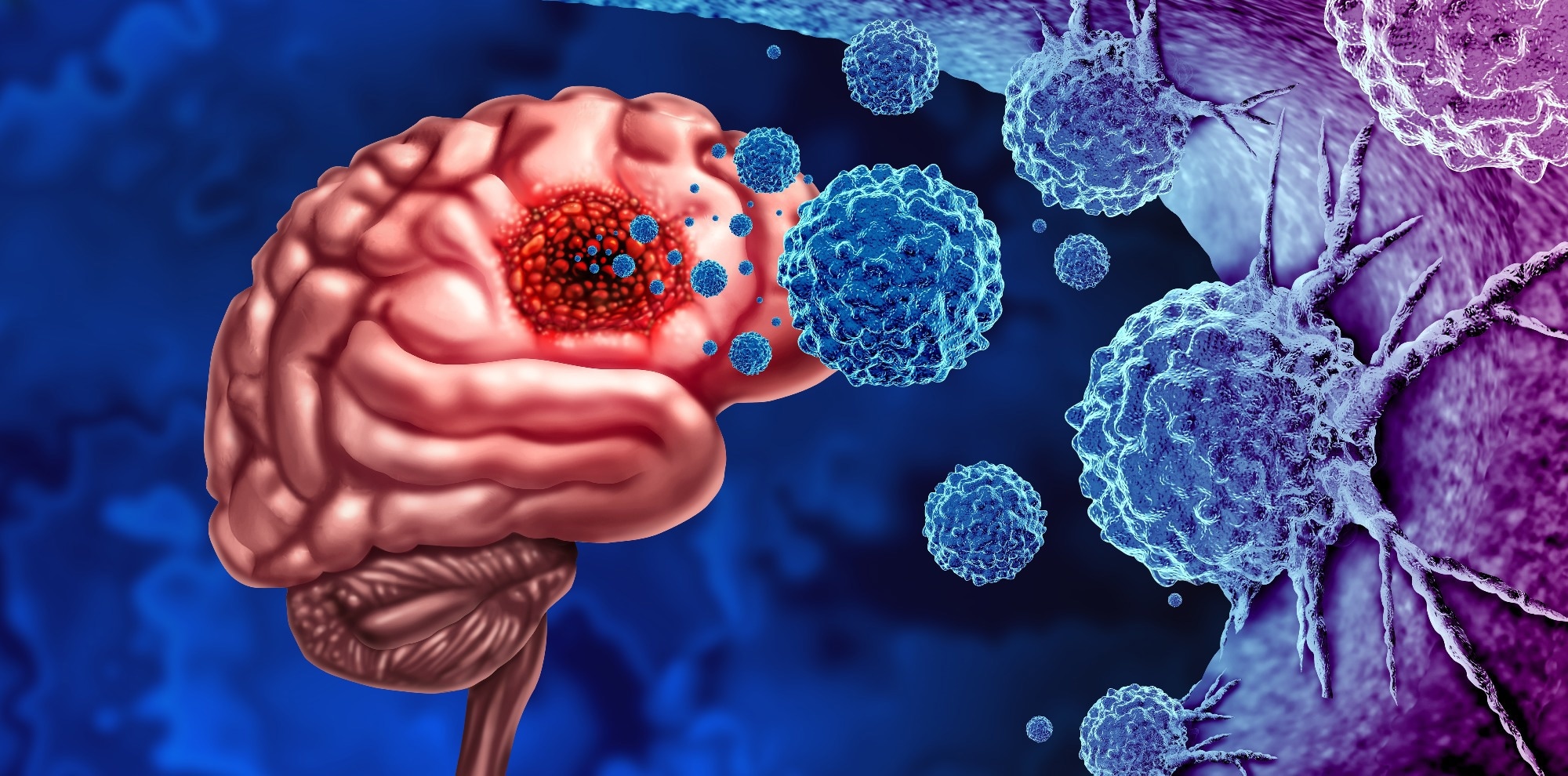 Study: Association between viral infections and glioma risk: a two-sample bidirectional Mendelian randomization analysis. Image Credit: Lightspring/Shutterstock.com