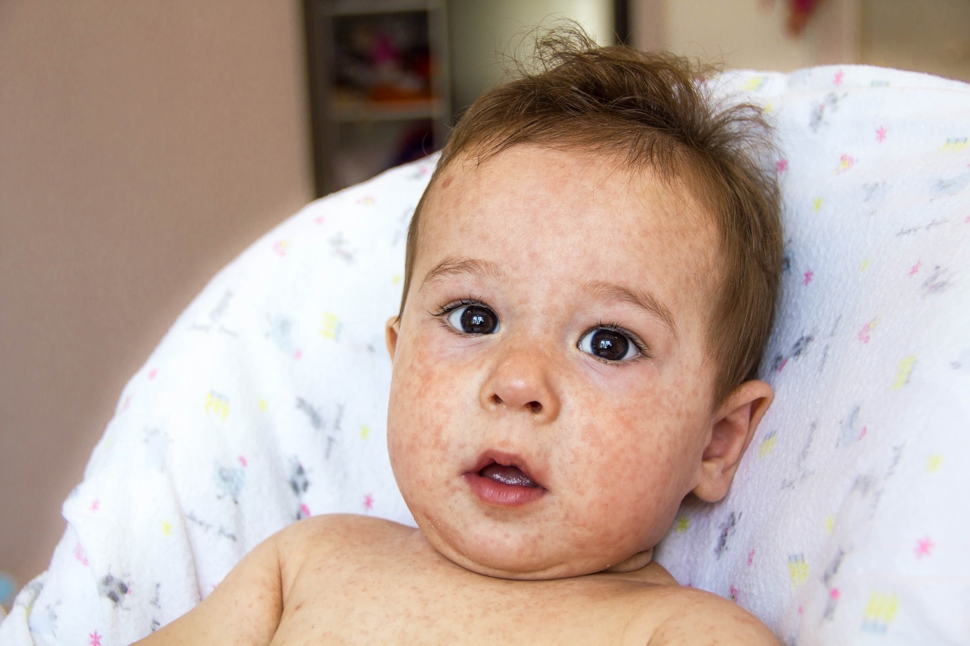 Study: Feast for Thought: A Comprehensive Review of Food Allergy 2021-2023. Image Credit: Yavdat / Shutterstock