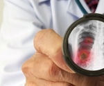 New study highlights the need for advanced pneumococcal vaccines in the wake of pre-COVID data