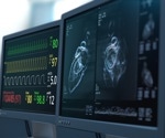 Alarming rise in infective endocarditis-related deaths among 25-44 year olds in the U.S.