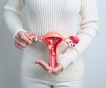 Could your diet impact endometriosis? Research points to dietary insights for treatment
