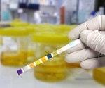 Early pandemic sees drop in child UTI diagnoses, severity unchanged