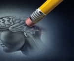 Alzheimer's disease found to have five distinct subtypes