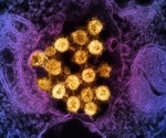 Paxlovid treatment in 20% of COVID-19 patients could avert 850,000 hospitalizations, save up to $170 billion