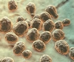 New study shows how brain glucose affects fungal disease treatment
