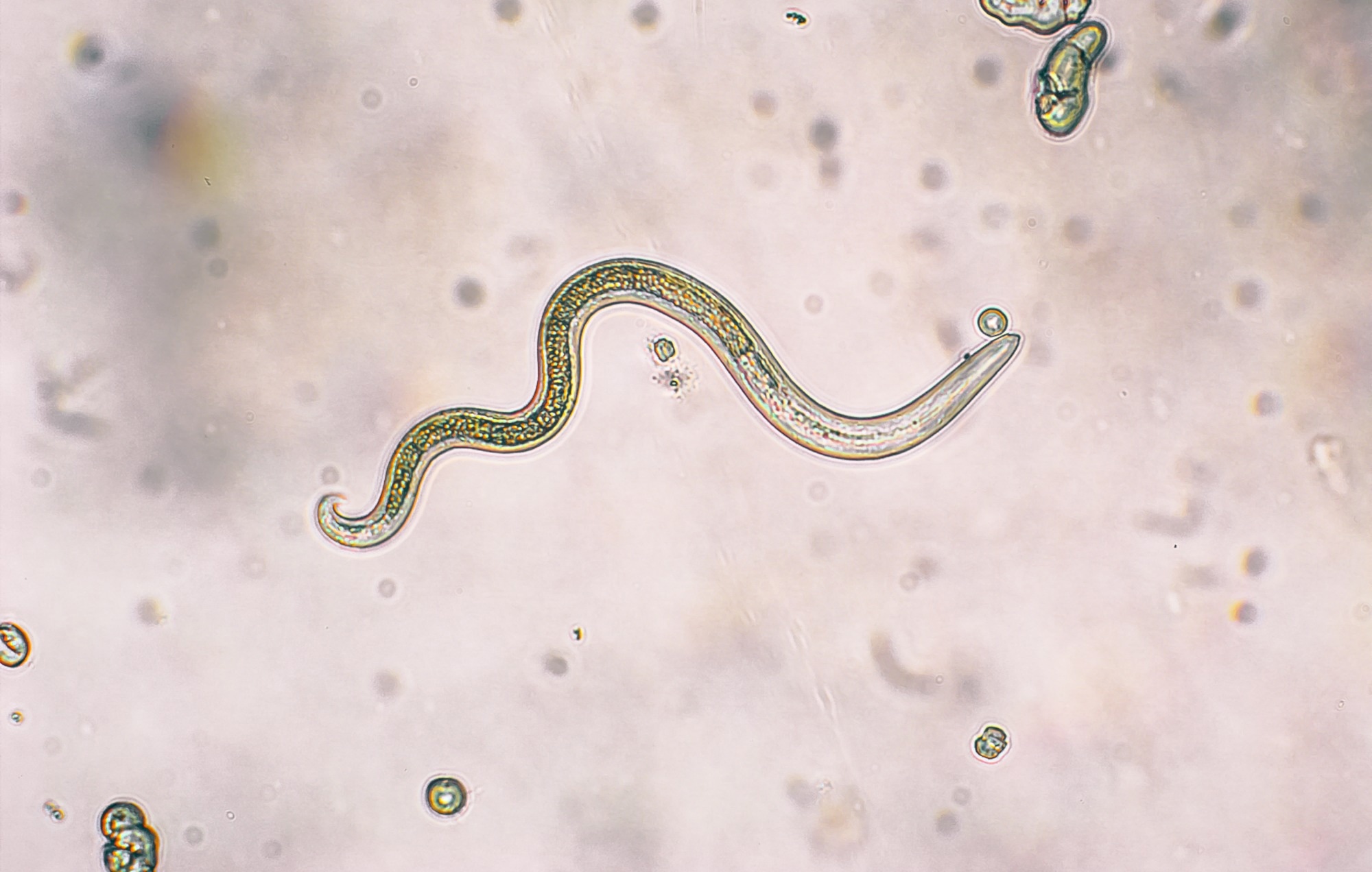 Study: Intestinal helminth infection impairs vaccine-induced T cell responses and protection against SARS-CoV-2. Image Credit: olgaru79 / Shutterstock