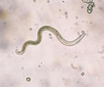 Study reveals intestinal helminth infection diminishes T cell response to COVID-19 mRNA vaccine