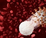 Study finds patients with long COVID exhibit complement dysregulation with signs of thromboinflammation