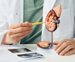 Study uncovers 23 new genetic markers linked to kidney health on the X-chromosome