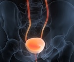 Bladder and gut fermentation syndromes: Uncommon disorders with significant implications