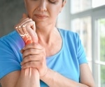 New study reveals optimal drug sequencing for postmenopausal osteoporosis treatment
