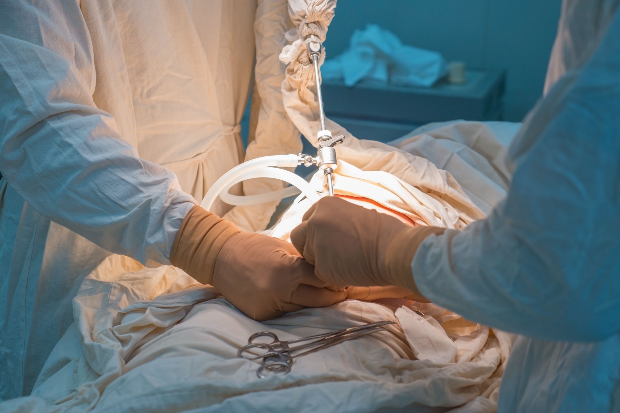 Study: Comparison of Sleeve Gastrectomy vs Roux-en-Y Gastric Bypass: A Randomized Clinical Trial. Image Credit: Donenko Oleksii / Shutterstock.com