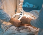 Comparing perioperative differences: Sleeve gastrectomy vs. Roux-en-Y gastric bypass