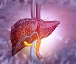 Risk of non-alcoholic fatty liver disease for cardiovascular disease and all cause death in patients with type 2 diabetes mellitus
