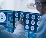 More than 3 billion people worldwide lived with a neurological condition in 2021, new study reports