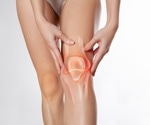 Joint hypermobility linked to longer COVID-19 recovery time