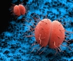 Rising antimicrobial resistance in STIs: A call for global action