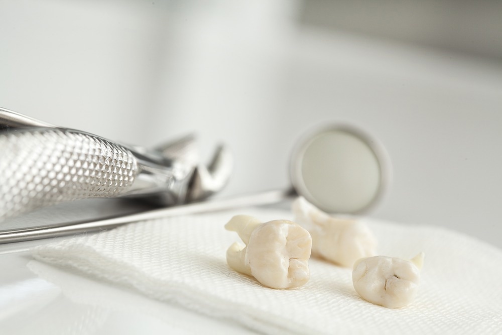Study: Brain atrophy in normal older adult links tooth loss and diet changes to future cognitive decline. Image Credit: sebra/Shutterstock.com