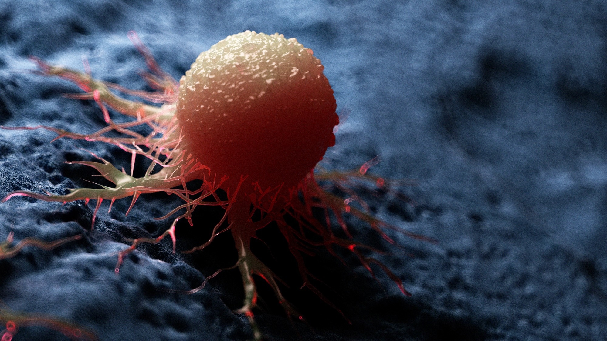 Study: Association between inflammatory bowel disease and cancer risk: evidence triangulation from genetic correlation, Mendelian randomization, and colocalization analyses across East Asian and European populations. Image Credit: Sebastian Kaulitzki / Shutterstock.com