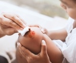 Wound warriors: How microbes influence healing and infection risks
