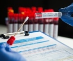 Global study reveals mismatch in COVID-19 treatment guidelines with WHO standards