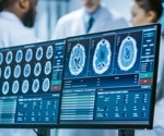 DELiVR's virtual reality training speeds up cell detection in complex brain datasets