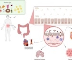Western diet linked to chronic diseases by gut microbiota disruption