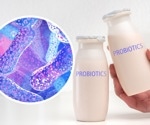 Gut microbiota and obesity: New study shows promising results with probiotic and prebiotic intervention