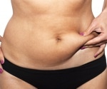 Body fat percentage beats BMI in predicting obesity-related health risks, study says